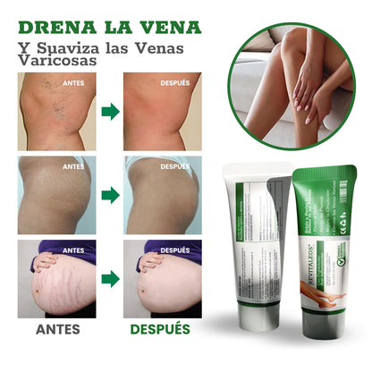 REVITALEGS® - Crema para Eliminar Venas Varices 3.87 fl. Oz